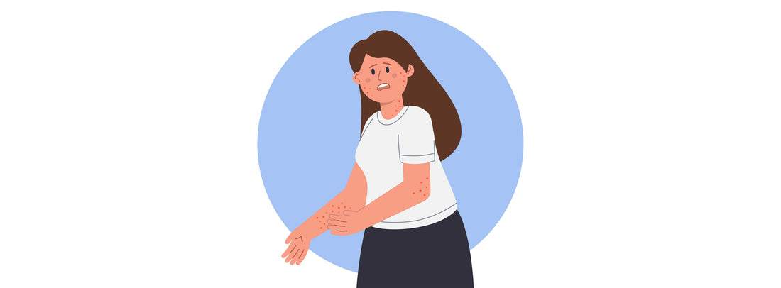 Rashes, Itching? Skin Health Explained